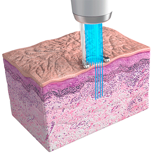 Discovery Resurfacing 1 e1525935098681 img