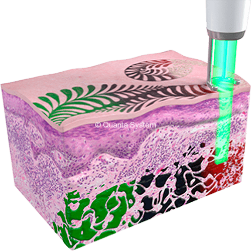 Discovery Tattoos 1064 e1523608786990 img