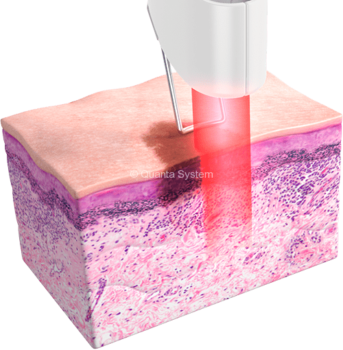 Thunder Rejuvenation red img