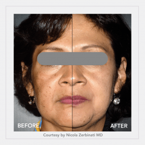 bronze e1611323769205 img