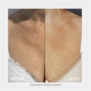 decollete-e1611323661124