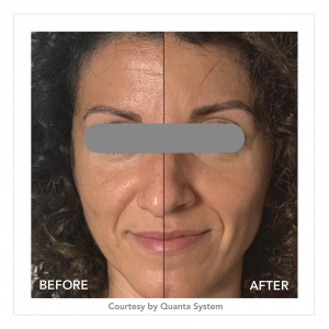 nat_peel-e1611323617512