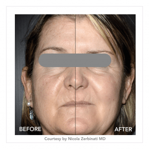 refresh e1611323705991 img