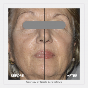 revivo-e1611323892471