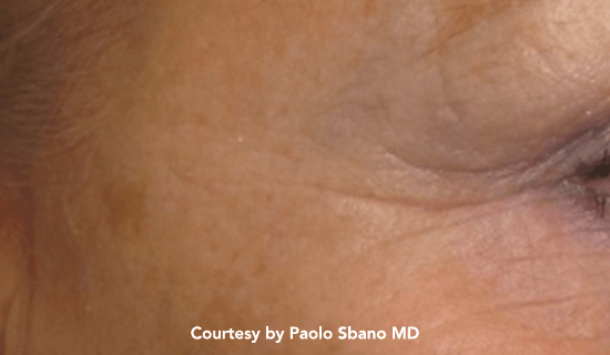 thunder rej post1 img