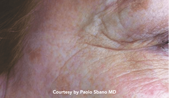 thunder rej pre1 img