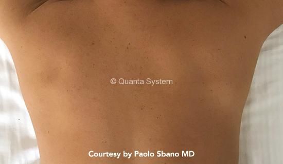 usa schiena post 1 img