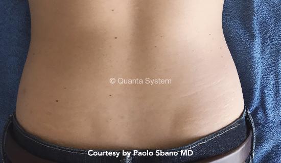 usa schiena post 2 img