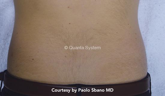 usa schiena pre 2 img