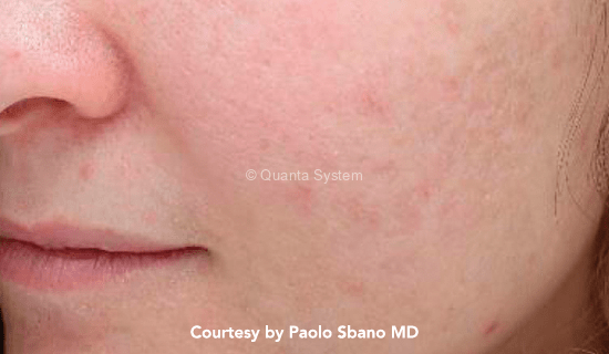 585 pig lesion post1 img