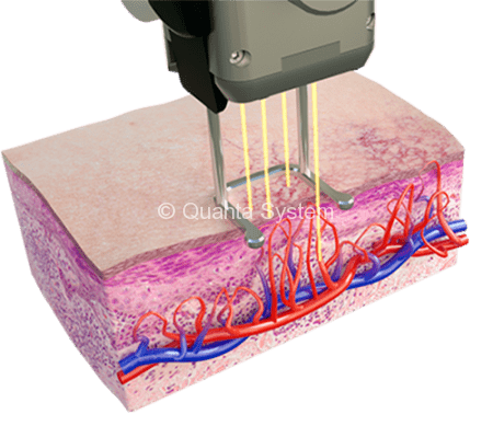 585 Vascolare Sezione e1527062828498 450x389 img