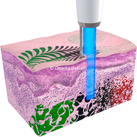 QPlus Tatuaggi 1064 1 e1525866778981 450x450 img