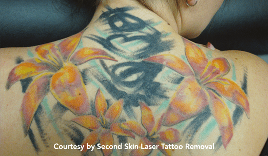 q plus tattoo pre1 img